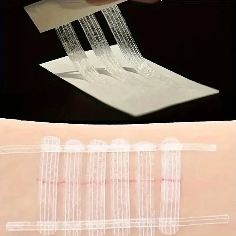 5 Wound Closure Strips For Postpartum Wound Repair Suture Free Medical Adhesive Tape For Cosmetic Surgery