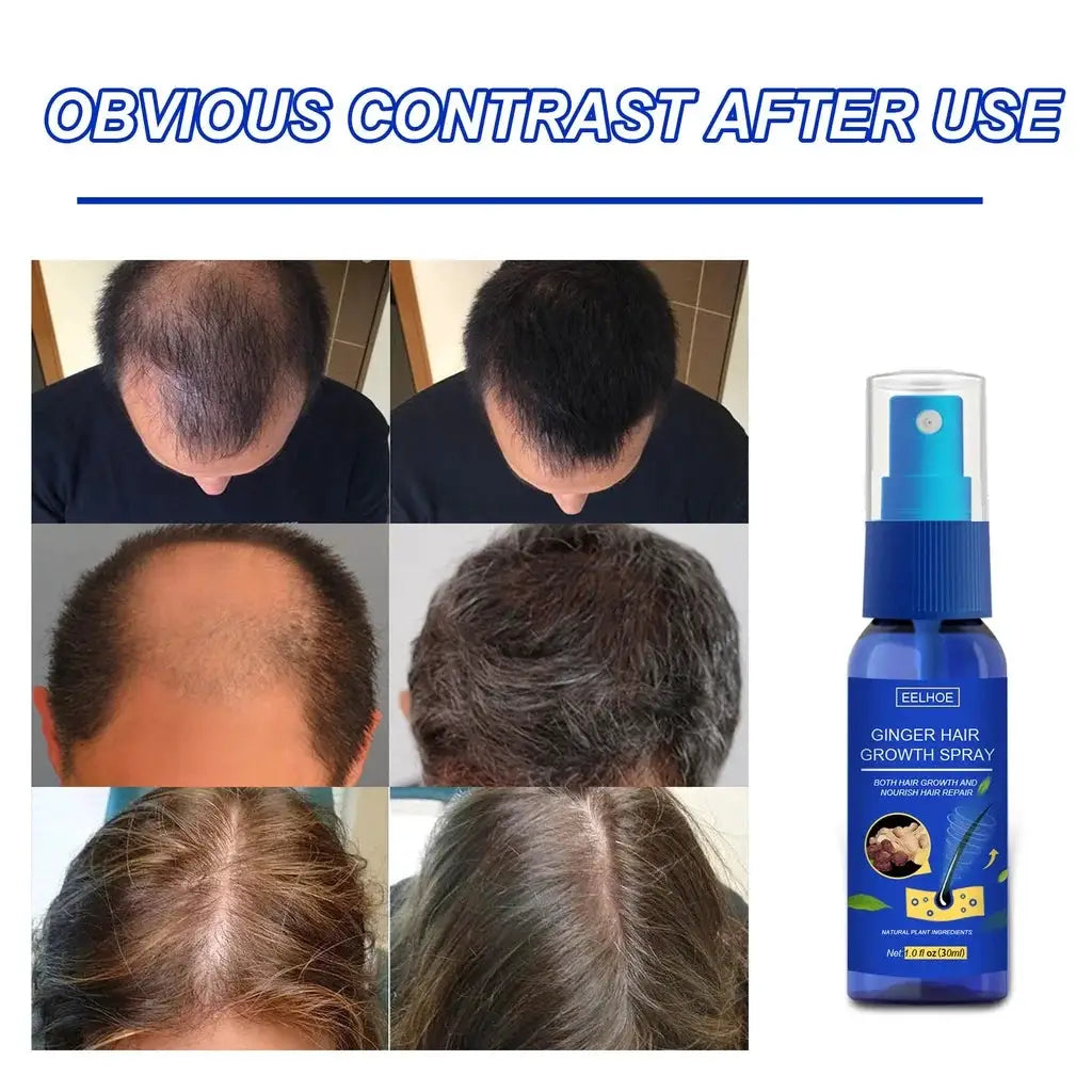 Ginger Hair Growth spray Anti Hair Fall Hair Loss Treatment Hair Growth Essence Oil for Men Women hair treatment