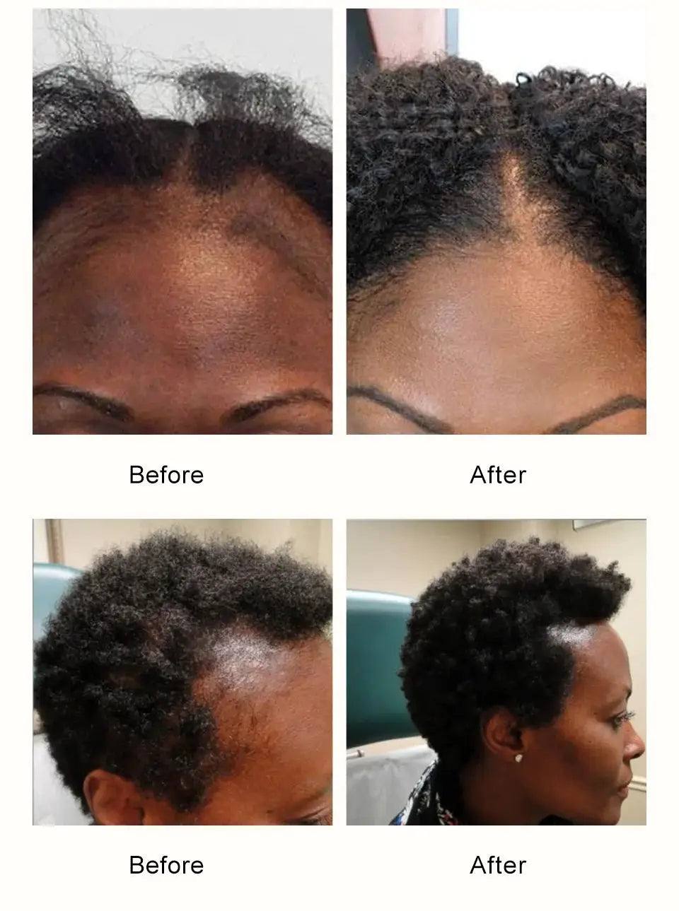 100% Natural Chebe Powder Natural Ingredients Promotes Hair Strengthens & Thickens Anti Hair Loss Hair Regrowth Treatment