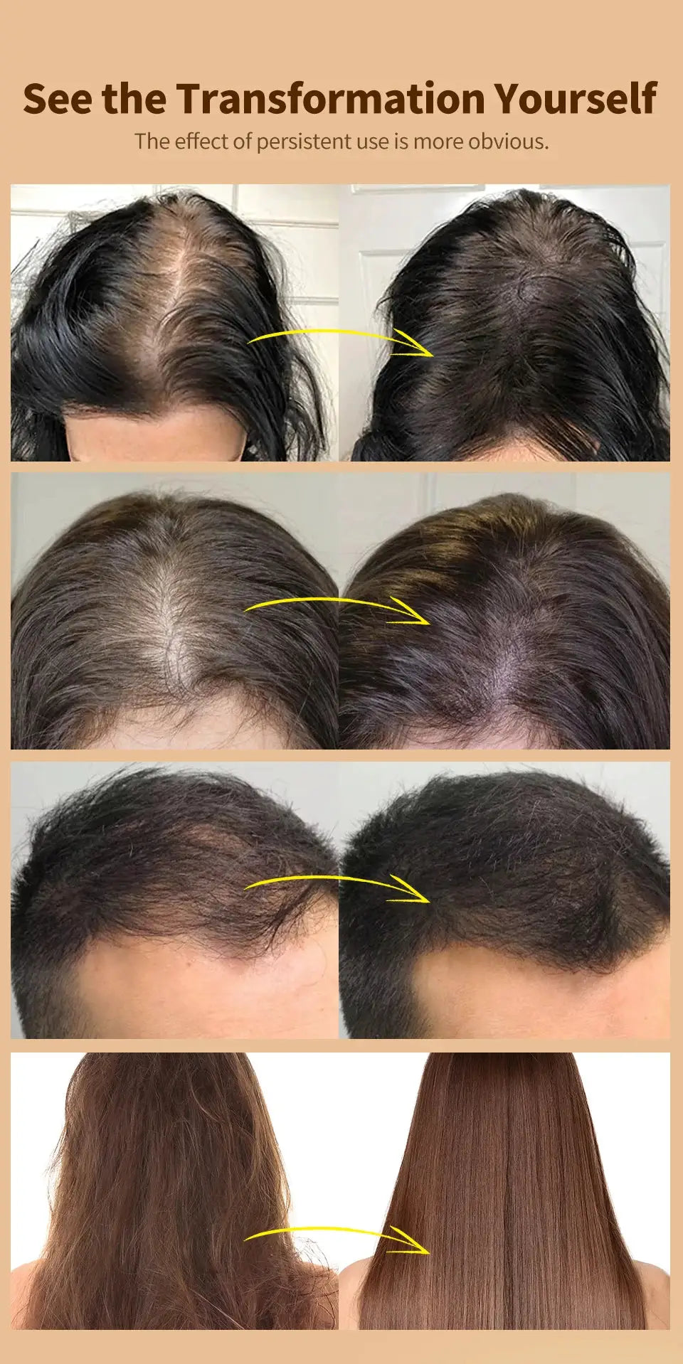Sevich 30ml Hebal Oil Essence Fast Hair Growth Spray Hair Loss Treatment Help for hair Growth Hair Care