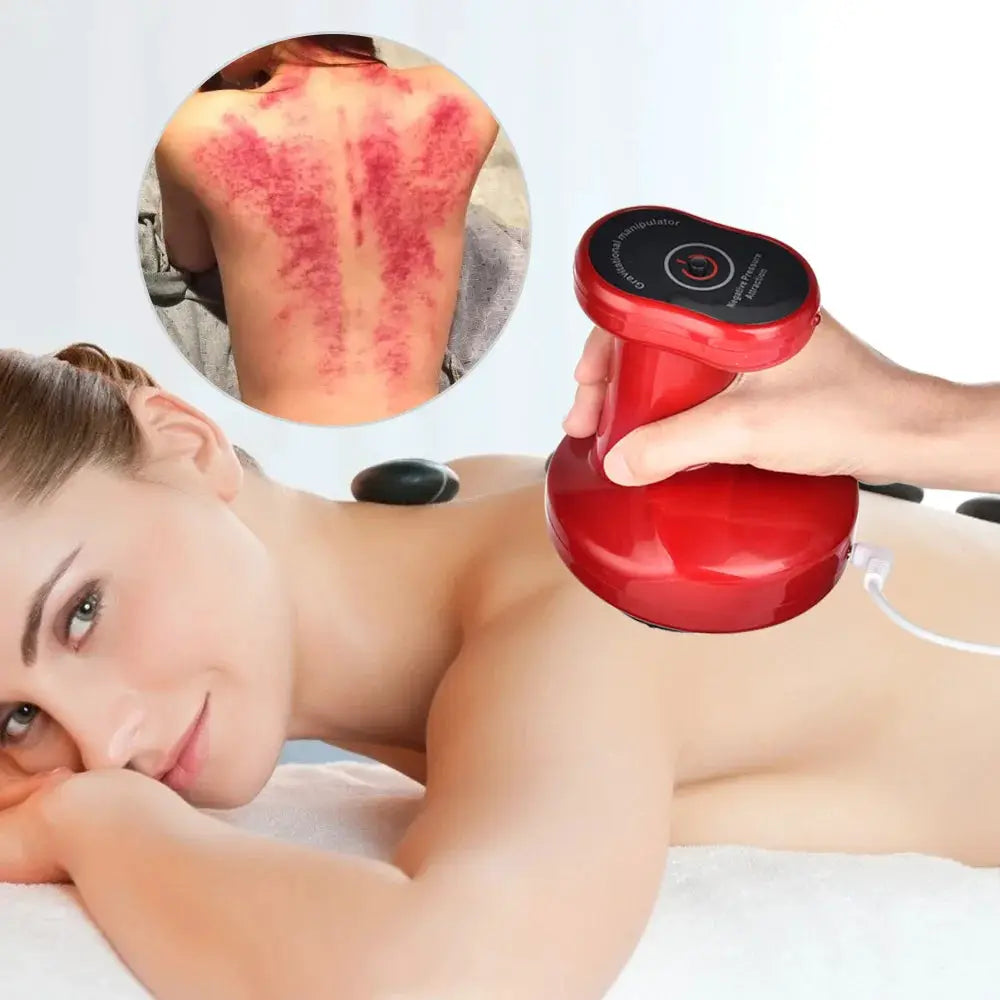 Red electric cupping massage device with EMS control used on a woman's back; inset shows cupping marks.
