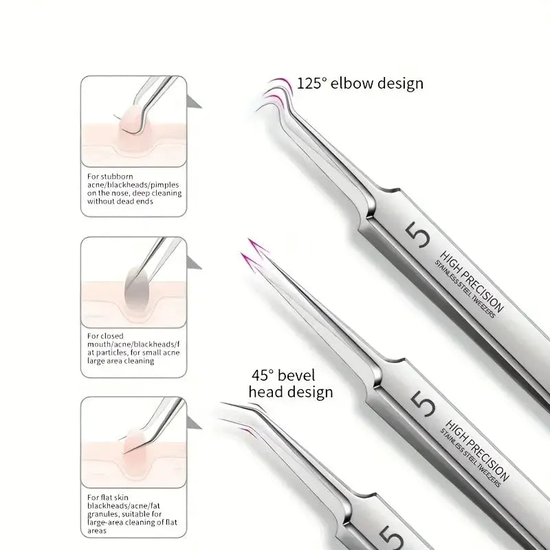 8 Piece Blackhead Remover Kit Stainless Steel Blemish Extraction Tools Professional Pimple Popper Set For All Skin