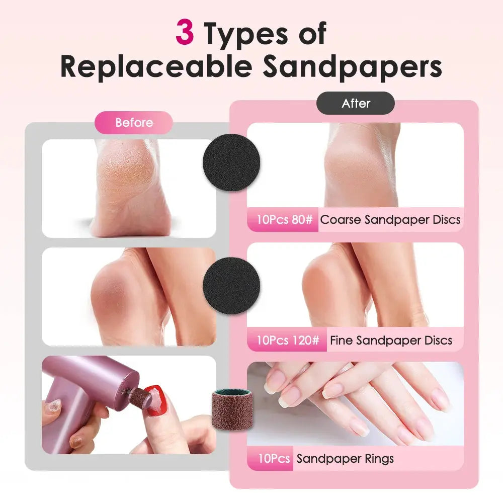 Electric foot callus remover by Simples Market, pink handheld grinder with replaceable coarse and fine sandpaper discs.
