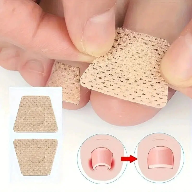 Nail Correction and Repair Patch Set - Simples Market
