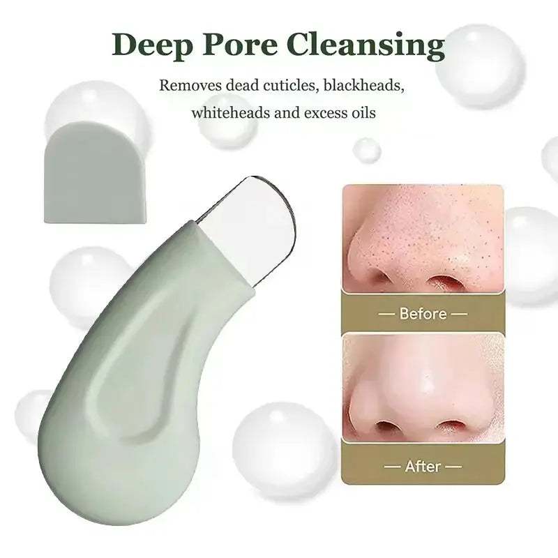 Blackhead and Whitehead Removal Tool for Nose and Face Skin Pore Cleaner Skin Care Tools for Women