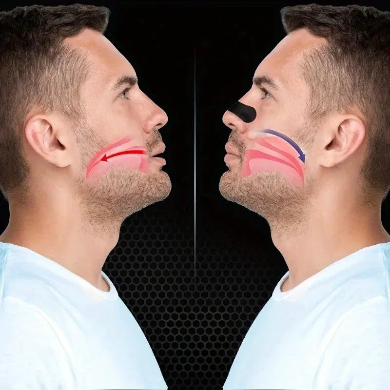 Nasal Strips With Enhanced Adhesion For Breathing During Exercise