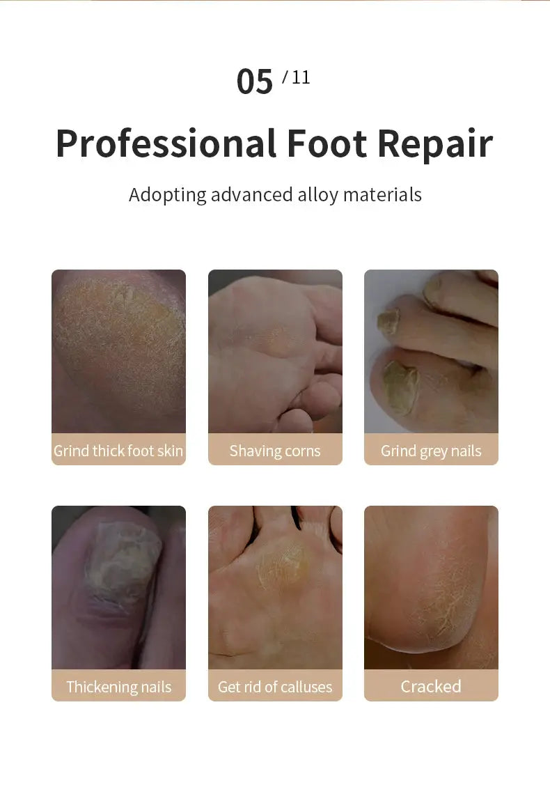 HOMEFISH electric foot grinder by Simples Market; six shots show thick skin, corns, nails, calluses and cracked skin