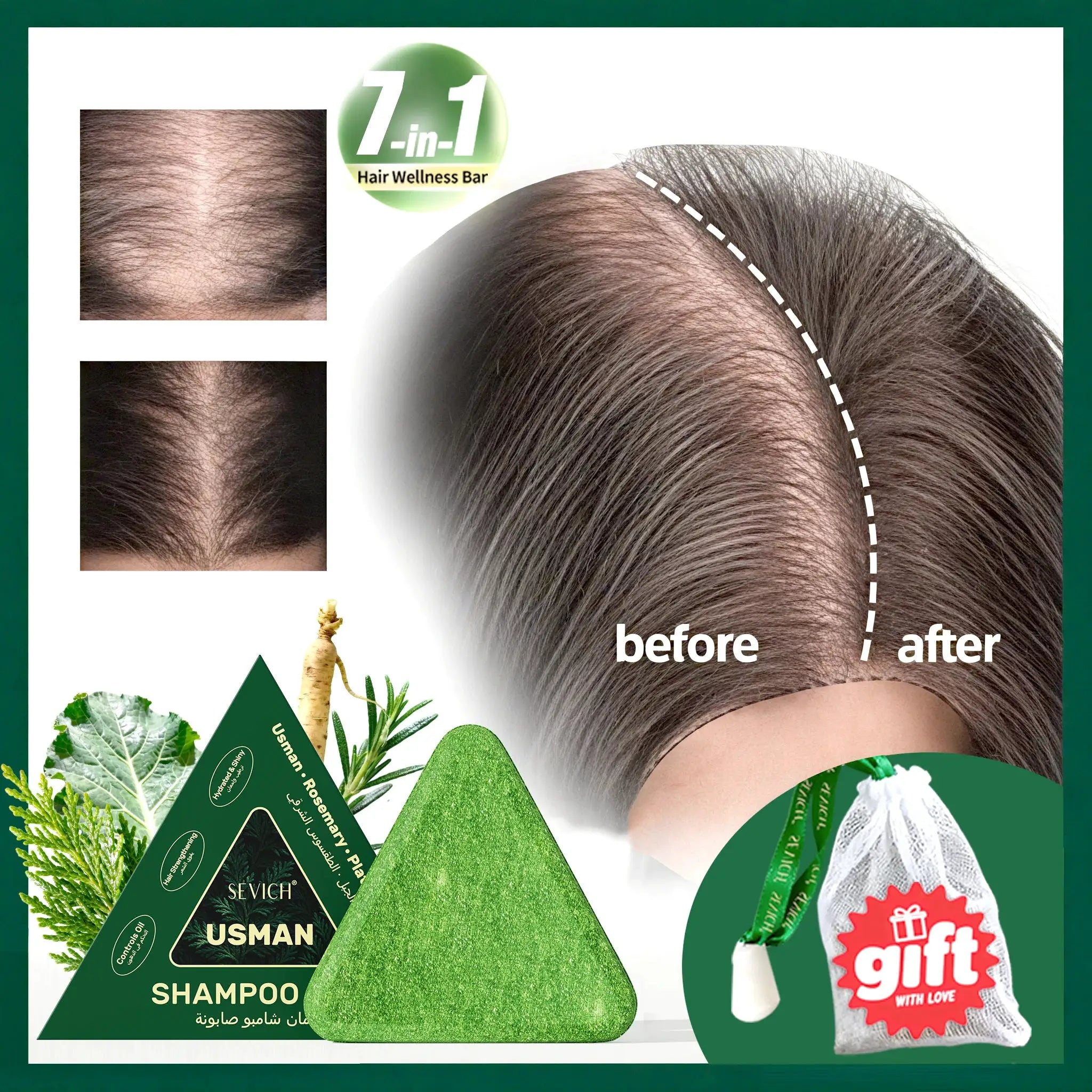 Anti Hair Loss Serum Set Hair Growth Essential Oil Usman Hair Regrowth Shampoo Soap Hair Care Thickening Oil Spray For Men Women