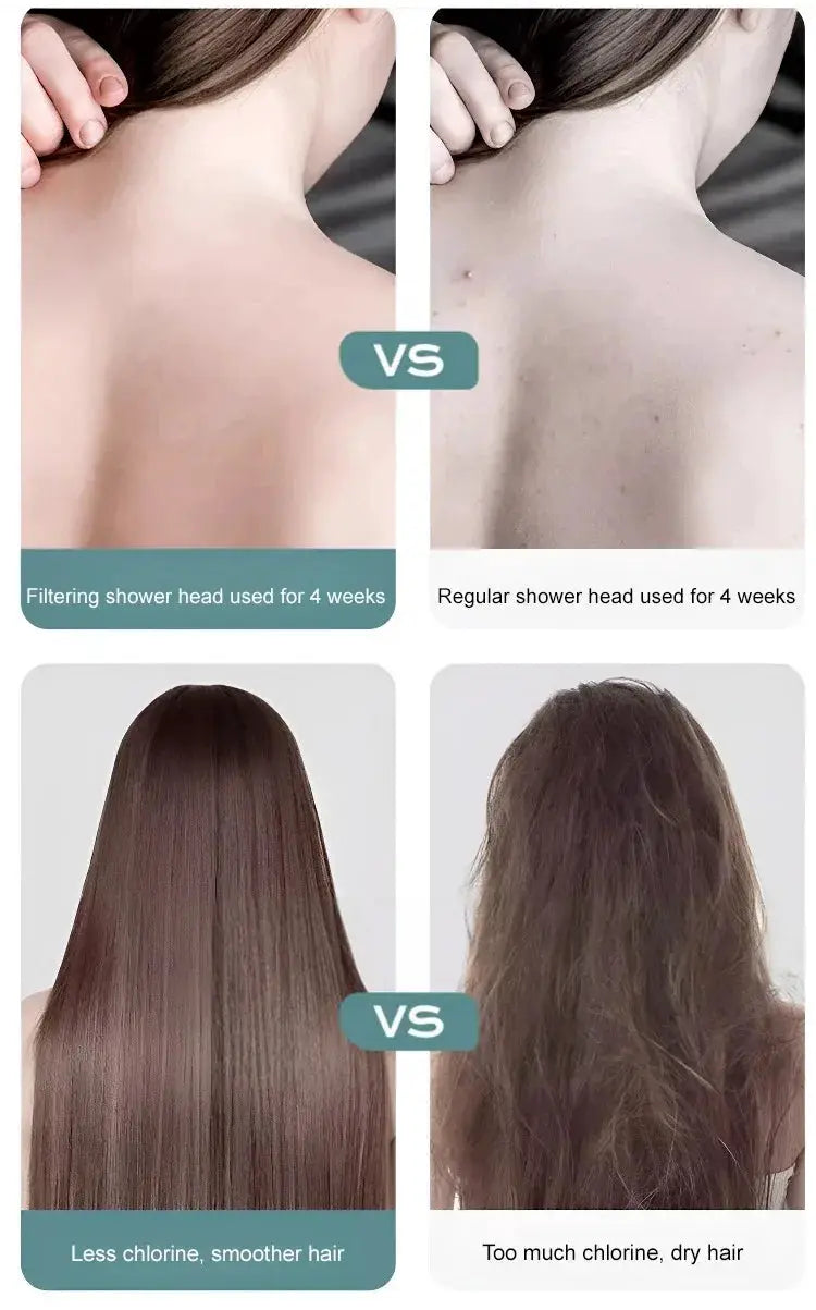 Simples Market high-pressure shower head with filter and 3 spray modes; before/after hair and skin results