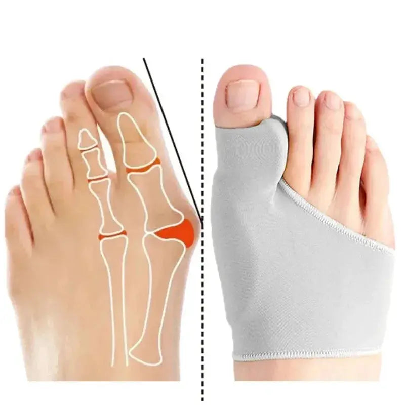 Hallux Valgus Bunion Corrector Orthotics Toe Separator for Foot Health and Pain Relief