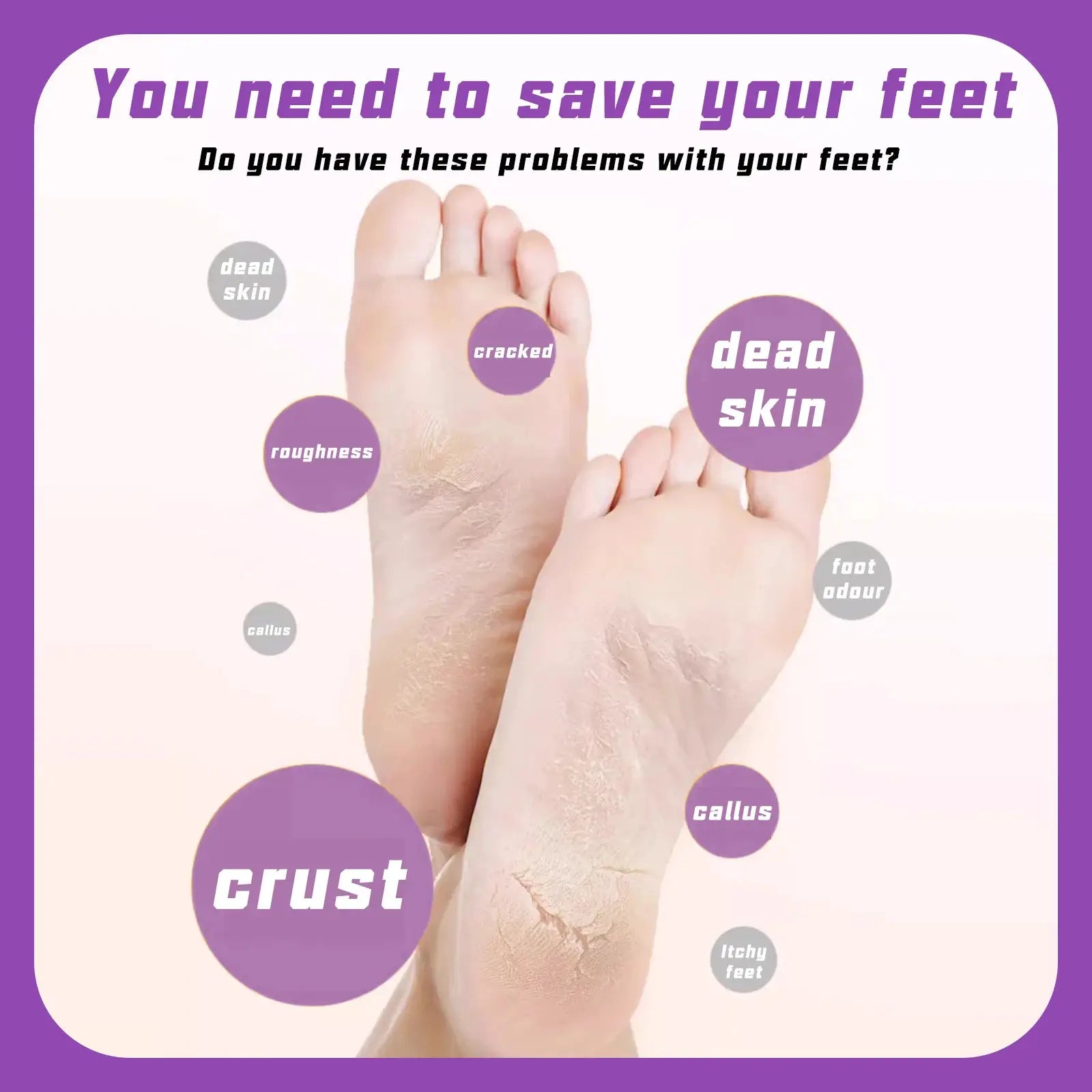 USB rechargeable electric foot callus remover by Simples Market with 60 replacement sandpapers